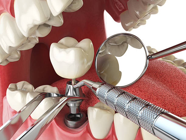 Best Emergency Dentist for Special Needs Patients in Seymour, IN