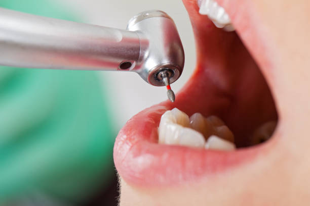 Best Pediatric Emergency Dentist in Seymour, IN